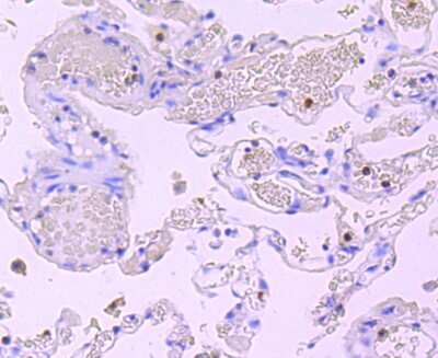 Immunohistochemistry-Paraffin: Myeloperoxidase/MPO Antibody (JM10-58) [NBP2-66964] - Analysis of paraffin-embedded human lung tissue using anti-Myeloperoxidase antibody. Counter stained with hematoxylin.