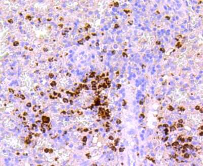 Immunohistochemistry-Paraffin: Myeloperoxidase/MPO Antibody (JM10-58) [NBP2-66964] - Analysis of paraffin-embedded human spleen tissue using anti-Myeloperoxidase antibody. Counter stained with hematoxylin.