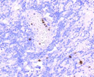 Immunohistochemistry-Paraffin: Myeloperoxidase/MPO Antibody (JM10-58) [NBP2-66964] - Analysis of paraffin-embedded human tonsil tissue using anti-Myeloperoxidase antibody. Counter stained with hematoxylin.