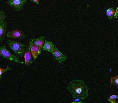 Immunocytochemistry/Immunofluorescence: Myeloperoxidase/MPO Antibody (SP72) [NBP2-12481] - MCF-7 cells. 
