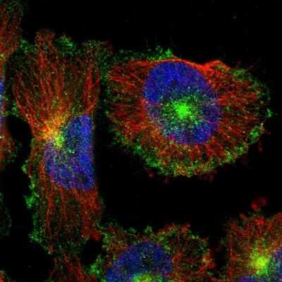 Immunocytochemistry/Immunofluorescence: Myoferlin Antibody [NBP1-84694] - Staining of human cell line U-251 MG shows localization to plasma membrane & vesicles.  Antibody staining is shown in green.