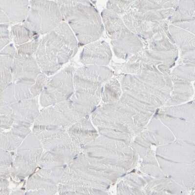 Immunohistochemistry-Paraffin: Myoferlin Antibody [NBP1-84694] - Staining of human skeletal muscle shows no positivity in myocytes as expected.