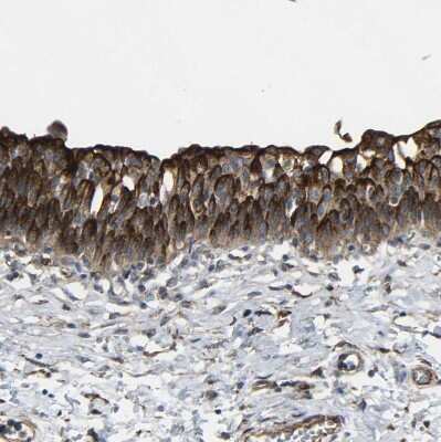 Immunohistochemistry-Paraffin: Myoferlin Antibody [NBP1-84694] - Staining of human urinary bladder shows strong membranous positivity in urothelial cells.