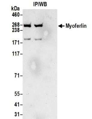 Immunoprecipitation: Myoferlin Antibody [NBP2-32264] - Samples:  Whole cell lysate (0.5 or 1.0 mg per IP reaction; 20% of IP loaded) prepared using NETN buffer from HeLa cells. Antibodies:  Affinity purified rabbit anti-Myoferlin antibody NBP2-32264 used for IP at 6 ug per reaction.  Myoferlin was also immunoprecipitated by rabbit anti-Myoferlin antibody BL16508.  For blotting immunoprecipitated Myoferlin, NBP2-32264 was used at 1 ug/ml.  Detection: Chemiluminescence with an exposure time of 30 seconds.