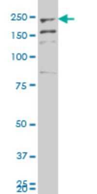 Western Blot: Myoferlin Antibody [H00026509-A01] - Analysis of FER1L3 expression in human stomach.