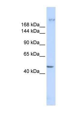 Western Blot: Myoferlin Antibody [NBP1-59396] - Titration: 0.2-1 ug/ml, Positive Control: MCF7 cell lysate.