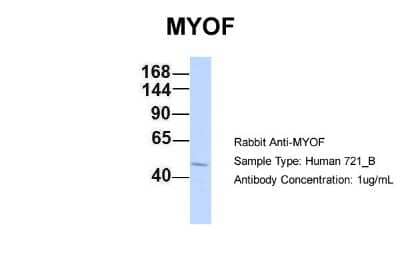 Western Blot: Myoferlin Antibody [NBP1-59396] - Analysis of 721_B cell lysate. Antibody Dilution: 1.0 ug/ml MYOF is strongly supported by BioGPS gene expression data to be expressed in Human 721_B cells.