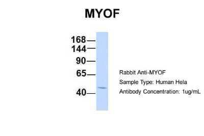 Western Blot: Myoferlin Antibody [NBP1-59396] - Hela, Antibody Dilution: 1.0 ug/ml MYOF is strongly supported by BioGPS gene expression data to be expressed in HeLa.