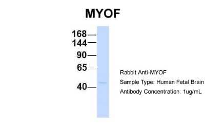 Western Blot: Myoferlin Antibody [NBP1-59396] - Human Fetal Brain, Antibody Dilution: 1.0 ug/ml.