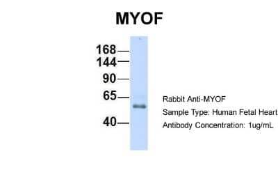 Western Blot: Myoferlin Antibody [NBP1-59396] - Human Fetal Heart, Antibody Dilution: 1.0 ug/ml.