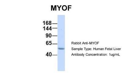 Western Blot: Myoferlin Antibody [NBP1-59396] - Human Fetal Liver, Antibody Dilution: 1.0 ug/ml.