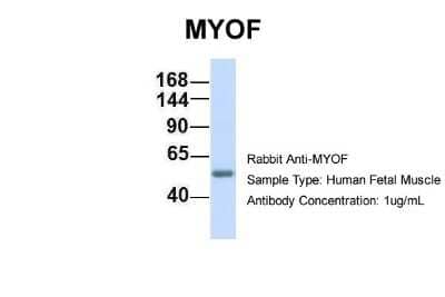 Western Blot: Myoferlin Antibody [NBP1-59396] - Human Fetal Muscle, Antibody Dilution: 1.0 ug/ml.