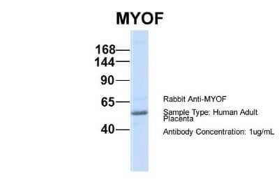 Western Blot: Myoferlin Antibody [NBP1-59396] - Sample Type: Human Adult Placenta Antibody Dilution: 1.0 ug/ml