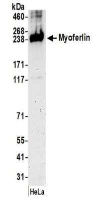 Western Blot: Myoferlin Antibody [NBP2-32264] - Samples:  Whole cell lysate (50 ug) prepared using NETN buffer from HeLa cells. Antibodies:  Affinity purified rabbit anti-Myoferlin antibody NBP2-32264 used for WB at 0.4 ug/ml.  Detection: Chemiluminescence with an exposure time of 3 minutes.