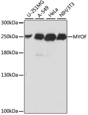 Western Blot: Myoferlin Antibody [NBP2-94759] - Analysis of extracts of various cell lines, using Myoferlin at 1:1000 dilution.Secondary antibody: HRP Goat Anti-Rabbit IgG (H+L) at 1:10000 dilution.Lysates/proteins: 25ug per lane.Blocking buffer: 3% nonfat dry milk in TBST.Detection: ECL Basic Kit .Exposure time: 2s.