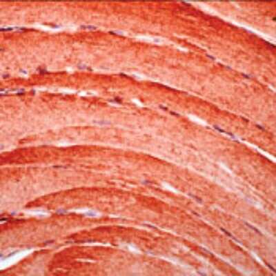 Immunohistochemistry-Paraffin: Myoglobin Antibody [NB120-9536] - Staining of Human Skeletal Muscle.