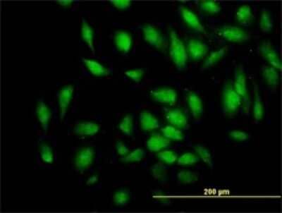 Immunocytochemistry/Immunofluorescence: Myomegalin Antibody (2B5) [H00009659-M01] - Analysis of monoclonal antibody to PDE4DIP on HeLa cell. Antibody concentration 10 ug/ml.