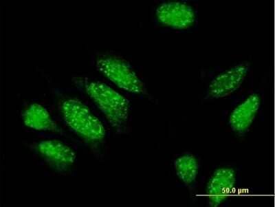 Immunocytochemistry/Immunofluorescence: Myomegalin Antibody [H00009659-B01P] - Analysis of purified antibody to PDE4DIP on HeLa cell. (antibody concentration 10 ug/ml)