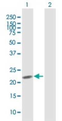 Western Blot: Myomegalin Antibody [H00009659-B01P] - Analysis of PDE4DIP expression in transfected 293T cell line by PDE4DIP polyclonal antibody.  Lane 1: PDE4DIP transfected lysate(19.47 KDa). Lane 2: Non-transfected lysate.