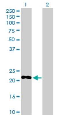 Western Blot: Myomegalin Antibody [H00009659-D01P] - Analysis of PDE4DIP expression in transfected 293T cell line by PDE4DIP polyclonal antibody.Lane 1: PDE4DIP transfected lysate(21.30 KDa).Lane 2: Non-transfected lysate.