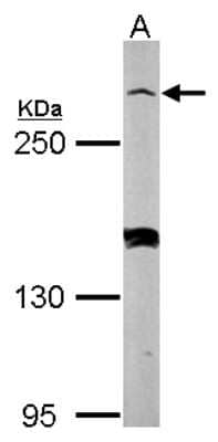 Western Blot: Myomegalin Antibody [NBP2-15031] - Sample (50 ug of whole cell lysate) A: mouse brain 5% SDS PAGE, antibody diluted at 1:3000.