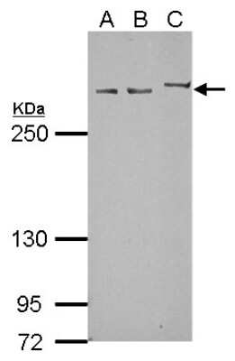 Western Blot: Myomegalin Antibody [NBP2-15031] - Sample (10 ug of whole cell lysate) A: NT2D1 B: PC-3 C: SK-N-SH 5% SDS PAGE; antibody diluted at 1:10000.