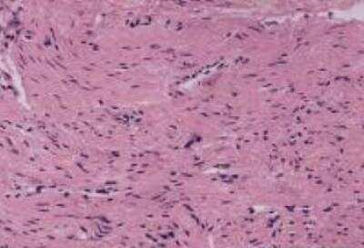 Hematoxylin & Eosin Stain: Myometrium Tissue Slides (Normal) [NBP2-30184] - Myometrium, normal.  Age/Sex: 37/F