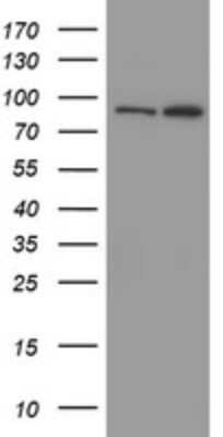 Western Blot: Myoneurin Antibody (3B9) [NBP2-46070] - Analysis of HEK293T cells were transfected with the pCMV6-ENTRY control (Left lane) or pCMV6-ENTRY Myoneurin.