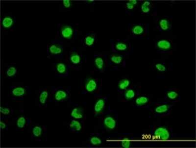 Immunocytochemistry/Immunofluorescence: Myoneurin Antibody (3E8) [H00055892-M01] - Analysis of monoclonal antibody to MYNN on HeLa cell. Antibody concentration 10 ug/ml.