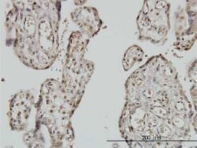 Immunohistochemistry-Paraffin: Myoneurin Antibody (3E8) [H00055892-M01] - Analysis of monoclonal antibody to MYNN on formalin-fixed paraffin-embedded human placenta. Antibody concentration 1 ug/ml.