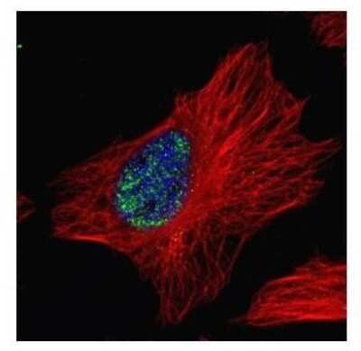 Immunocytochemistry/Immunofluorescence: Myoneurin Antibody [NBP2-19451] - Confocal immunofluorescence analysis of paraformaldehyde-fixed HeLa, using Myoneurin antibody (Green) at 1:500 dilution. Alpha-tubulin filaments are labeled with Alpha-tubulin antibody (Red) at 1:2000.