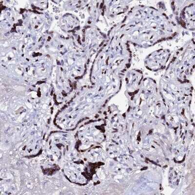 Immunohistochemistry-Paraffin: Myoneurin Antibody [NBP1-92157] - Staining of human placenta shows strong nuclear positivity in trophoblastic cells.