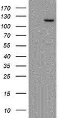 Western Blot: Myoneurin Antibody (OTI1F10) - Azide and BSA Free [NBP2-72863] - HEK293T cells were transfected with the pCMV6-ENTRY control (Left lane) or pCMV6-ENTRY Myoneurin (Right lane) cDNA for 48 hrs and lysed. Equivalent amounts of cell lysates (5 ug per lane) were separated by SDS-PAGE and immunoblotted with anti-Myoneurin.