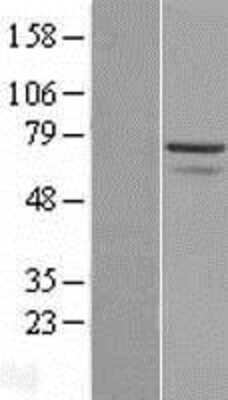 Western Blot: Myoneurin Overexpression Lysate (Adult Normal) [NBL1-13434] Left-Empty vector transfected control cell lysate (HEK293 cell lysate); Right -Over-expression Lysate for Myoneurin.