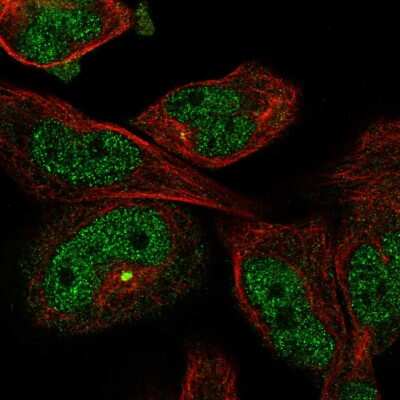 Immunocytochemistry/Immunofluorescence: Myosin 18B Antibody [NBP1-89967] - Staining of human cell line RH-30 shows localization to nucleoplasm & centrosome. Antibody staining is shown in green.