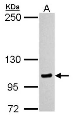 Western Blot: Myosin 1C Antibody [NBP2-19454] - Sample (30 ug of whole cell lysate) A: A431 5% SDS PAGE gel, diluted at 1:1000.