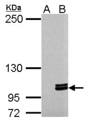 Western Blot: Myosin 1C Antibody [NBP2-19454] - Sample (30 ug of whole cell lysate) A: Non-transfected 293T lysates B: MYO1C transfected 293T lysate 5% SDS PAGE gel, diluted at 1:5000.