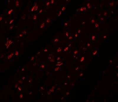 Immunocytochemistry/Immunofluorescence: Myosin Heavy Chain 3 Antibody [NBP2-81967] - Analysis of Myosin Heavy Chain 3 in mouse heart tissue with Myosin Heavy Chain 3 antibody at 20 ug/ml.