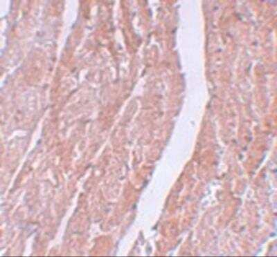 Immunohistochemistry: Myosin Heavy Chain 3 Antibody [NBP2-81967] - Analysis of Myosin Heavy Chain 3 in mouse heart tissue with Myosin Heavy Chain 3 antibody at 5 ug/ml.