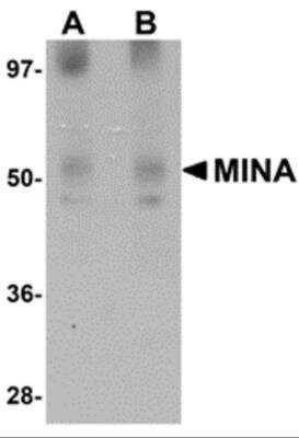 Western Blot: Myosin Heavy Chain 3 Antibody [NBP2-81967] - Analysis of Myosin Heavy Chain 3 in human heart tissue lysate with Myosin Heavy Chain 3 antibody at (A) 1 and (B) 2 ug/ml.