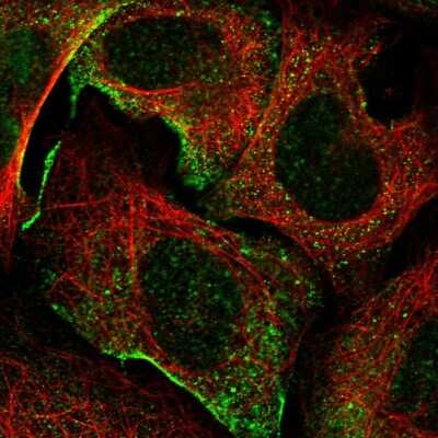 Immunocytochemistry/Immunofluorescence: Myosin IXA Antibody [NBP1-92160] - Immunofluorescent staining of human cell line U-2 OS shows localization to plasma membrane.