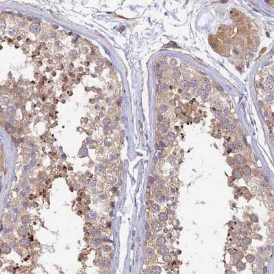 Immunohistochemistry-Paraffin: Myosin IXA Antibody [NBP1-92159] - Staining of human testis shows strong cytoplasmic positivity in subsets of cells in seminiferous ducts.