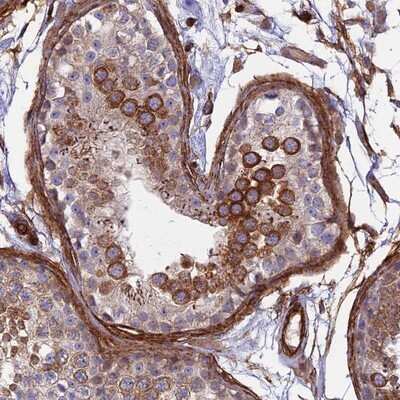 Immunohistochemistry-Paraffin: Myosin IXA Antibody [NBP1-92160] - Staining of human testis shows strong cytoplasmic positivity in cells in seminiferus ducts.