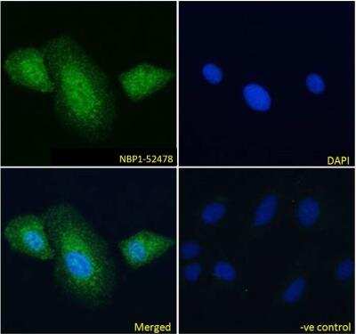 Immunofluorescence: Myosin Phosphatase Antibody [NBP1-52478] - Myosin Phosphatase antibody immunofluorescence analysis of paraformaldehyde fixed U2OS cells, permeabilized with 0.15% Triton. Primary incubation 1hr (10ug/ml) followed by Alexa Fluor 488 secondary antibody (4ug/ml), showing cytoplasmic and some nuclear staining.