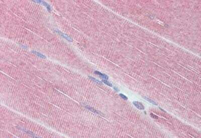 Immunohistochemistry-Paraffin: Myosin Phosphatase Antibody [NBP1-52478] - Analysis of anti-PPP1R12A / MYPT1 antibody with human skeletal muscle at concentration 3.75 ug/ml.