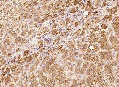 Immunohistochemistry-Paraffin: Myosin VIIa Antibody [NBP3-05833] - Staining of human MYO7A in human adrenal gland with rabbit polyclonal antibody at 1:100 dilution.