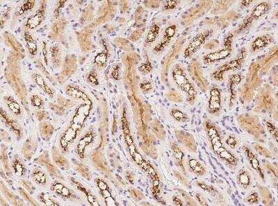 Immunohistochemistry-Paraffin: Myosin VIIa Antibody [NBP3-05833] - Staining of human MYO7A in human kidney with rabbit polyclonal antibody at 1:100 dilution.