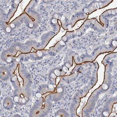 Immunohistochemistry-Paraffin: Myosin VIIb Antibody [NBP1-87506] - Staining of human duodenum shows strong membranous positivity in glandular cells.