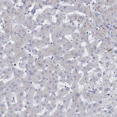 <b>Orthogonal Strategies Validation. </b>Immunohistochemistry-Paraffin: Myosin VIIb Antibody [NBP1-87506] - Staining of human liver shows low expression as expected.