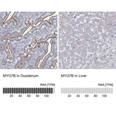 Immunohistochemistry-Paraffin Myosin VIIb Antibody